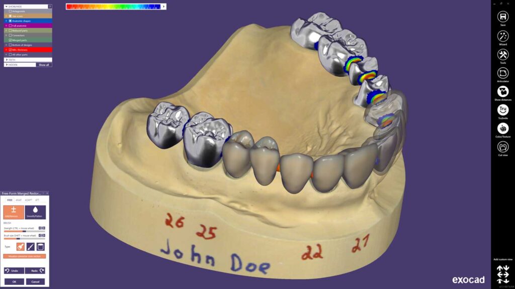 Exocad - Kaufen, Schulung & Fortbildung - the cad-cam-house