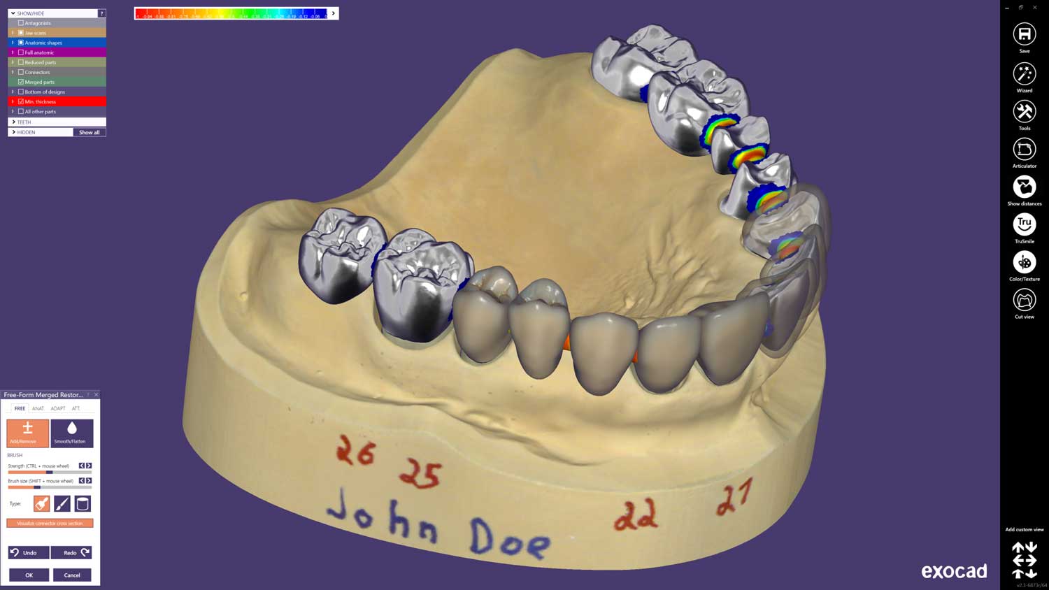 exocad-DentalCAD-Page-05-Preview-2048x1152-1